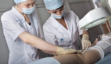 Chirurgische Behandlung von Krampfadern