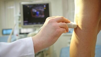 Laserbehandlung von Krampfadern